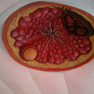 Carpa Cáncer de Mama - Imagen 4