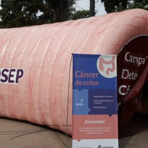 Carpa Colon - Imagen 1